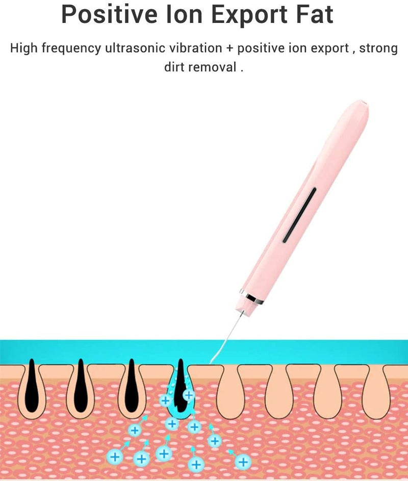 Xiaomi inFace Ion Ultrasonic Skin Scrubber Blackhead Remover