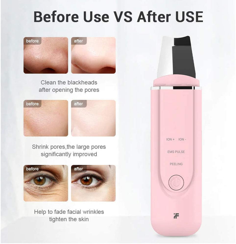 Xiaomi inFace Ion Ultrasonic Skin Scrubber Blackhead Remover
